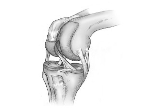 The difference between joint injuries